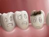 Is Extraction or a Root Canal Better for Your Infected Tooth?