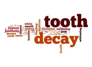 tooth decay