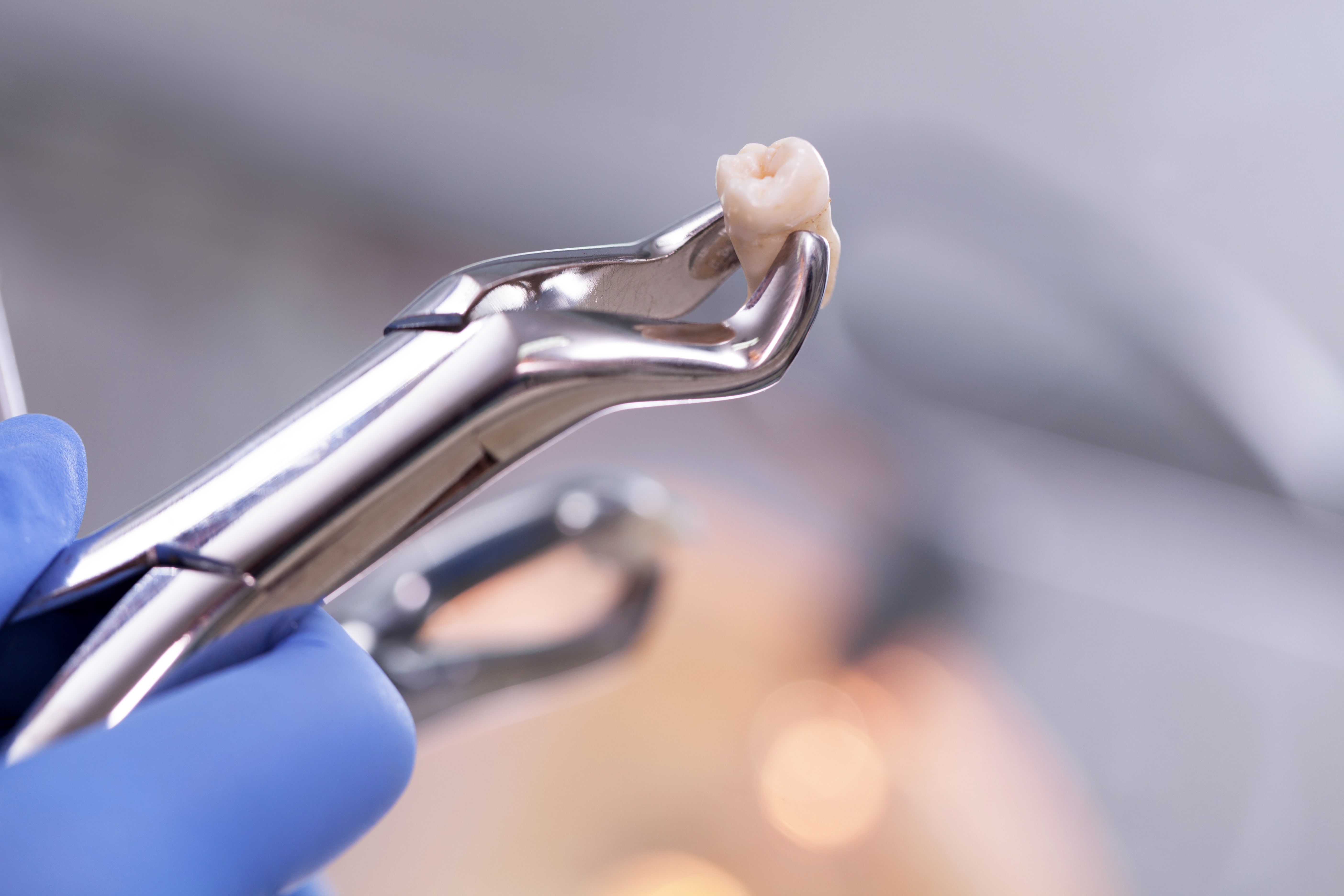 Удаление зубов какой врач. Хирургическая стоматология. Сложные стоматологические операции.