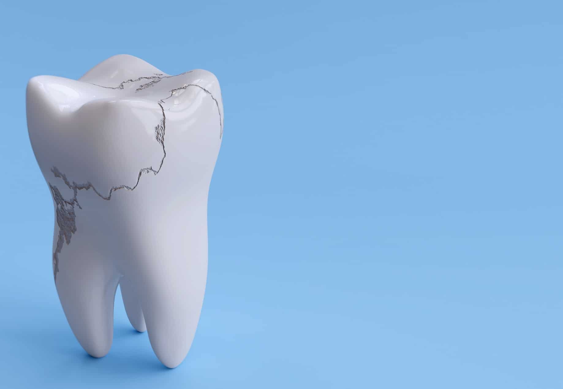 fixing-a-fractured-or-broken-tooth-conroe-tx