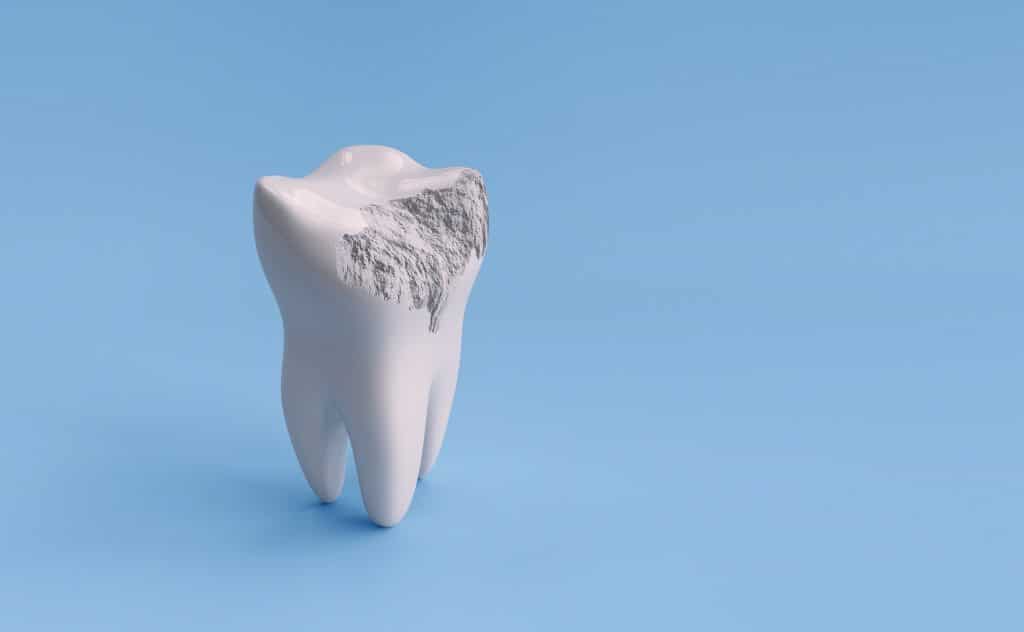 What to Do When a Tooth Breaks Conroe, TX