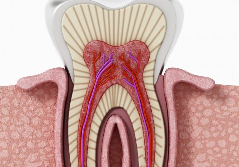 Saving a Tooth with an Infected Root Canal | Conroe, TX