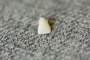 What Steps Should You Take After Tooth Loss?