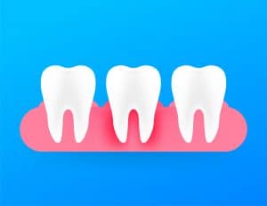 Gum disease, periodontitis. Healthy white tooth. Vector stock illustration