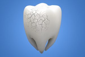 Illness Tooth on blue background. 3d illustration.
