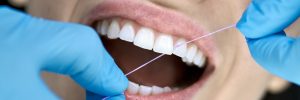 Delightful girl in a dental clinic. Dentist in blue latex gloves is flossing her teeth with a help of a dental floss. Closeup horizontal photo.