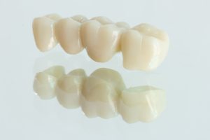 4 units​ zirconia​ bridge​ with​ all porcelain with a reflection on the glass.