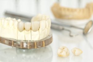 Metal free ceramic dental crowns