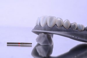 Close up of a dental model with veneers mounted on with dental tools isolated.