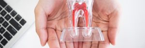 Professional dentist hold and show transparent crystal artificial red root tooth figure model ceramic material object for medical dental oral care in two palms hand for clinic and hospital explain
