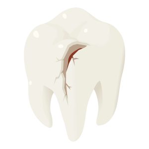 Cracked tooth icon. Isometric of cracked tooth vector icon for web design isolated on white background