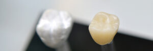 several models artificial human dental crown close-up