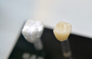 several models artificial human dental crown close-up