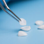Are Porcelain Veneers Right For You?