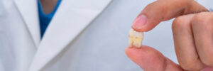 A dentist using finger hold an extracted wisdom tooth on the white background