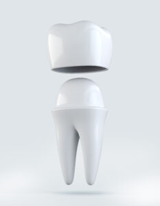 3D illustration of Crown tooth on white, dental concept.