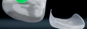 dental veneers with holder