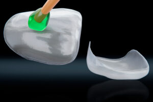 dental veneers with holder