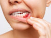 Important Elements To Know About Gum Disease