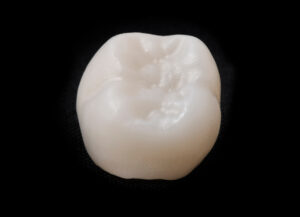 ceramic crown in dental laboratory