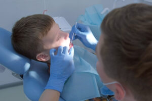 Dentist making fluoridation of child boy teeth after cleaning for protection. Doctor hygienist applying fluoride to teen teeth with brush. Covering teeth with fluoride gel in dentistry. Cure concept.