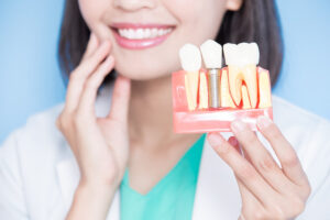 woman dentist take implant tooth and touch tooth on the blue background