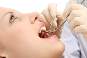 conroe dental checkup