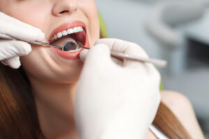 Close up of hands of dentist. He is checking teeth of women with concentration. The lady is opening her moth widely