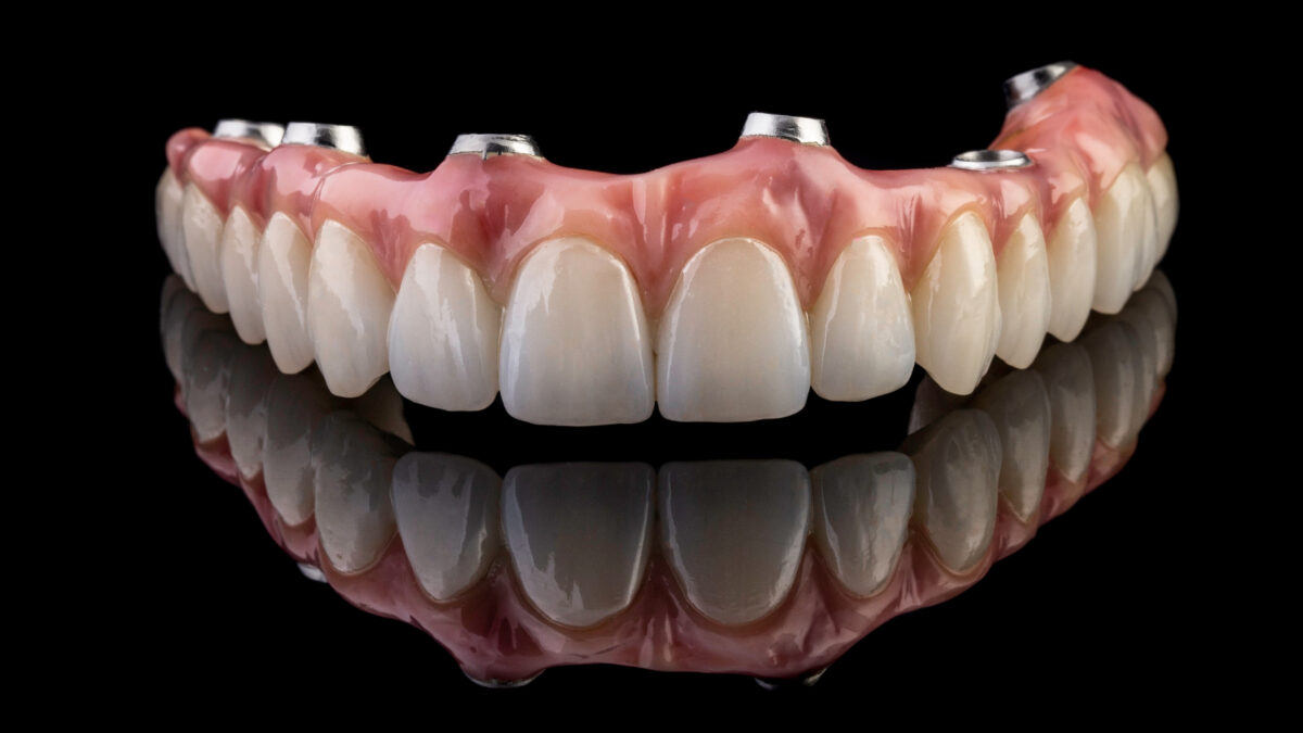 Can Dentures Restore Your Bite? Conroe, TX