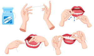 Set of dental floss and how to use illustration