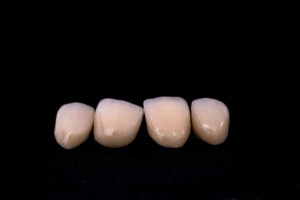 Ceramic zirconia metal-free crowns. Close-up dental photo Isolat