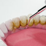 Schedule Your Next Periodontal Cleaning