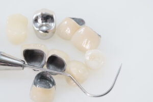 Implan model tooth support fix bridge implan and crown.