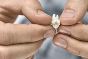 Male hands are holding an extracted molar tooth on the blurred background. Closeup horizontal photo.