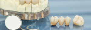 conroe restorative dental care