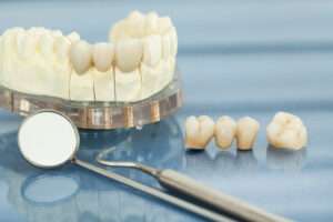 conroe restorative dental care