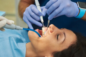conroe dental cleanings
