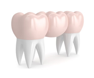 conroe dental bridges